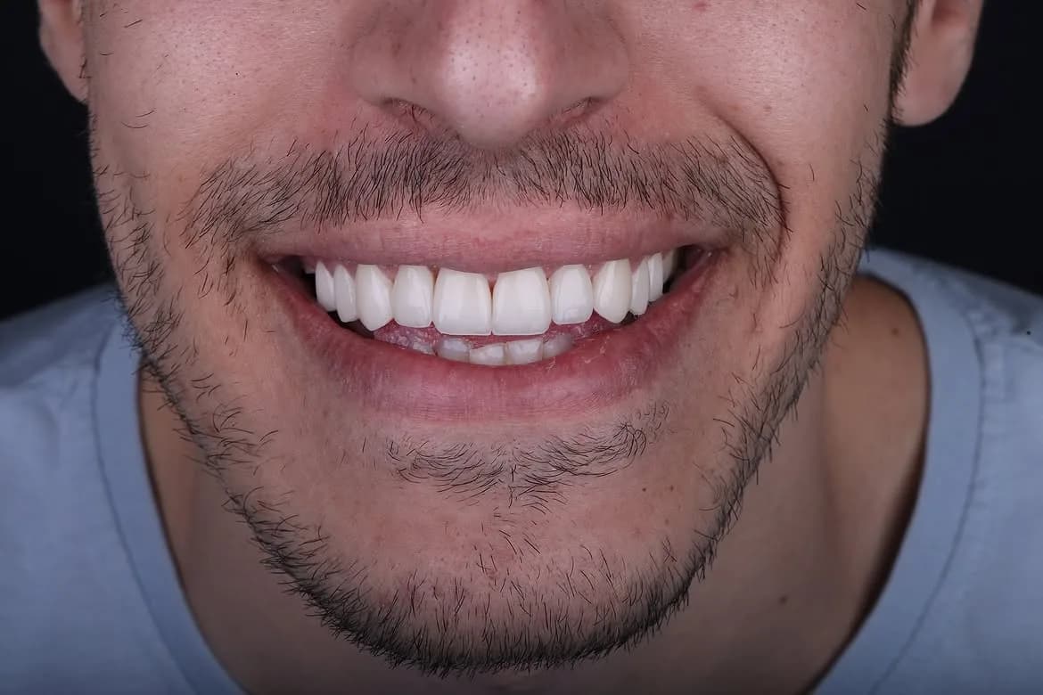 بعد